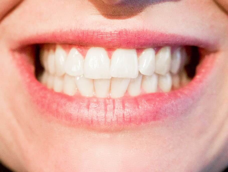 Hulme Court Dental and Implant Centre Dental Services - Dental Fillings Ivory White Teeth Closeup