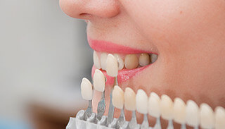 Hulme Court Dental and Implant Centre Dental Services - Dental Veneers Teeth Color Matching